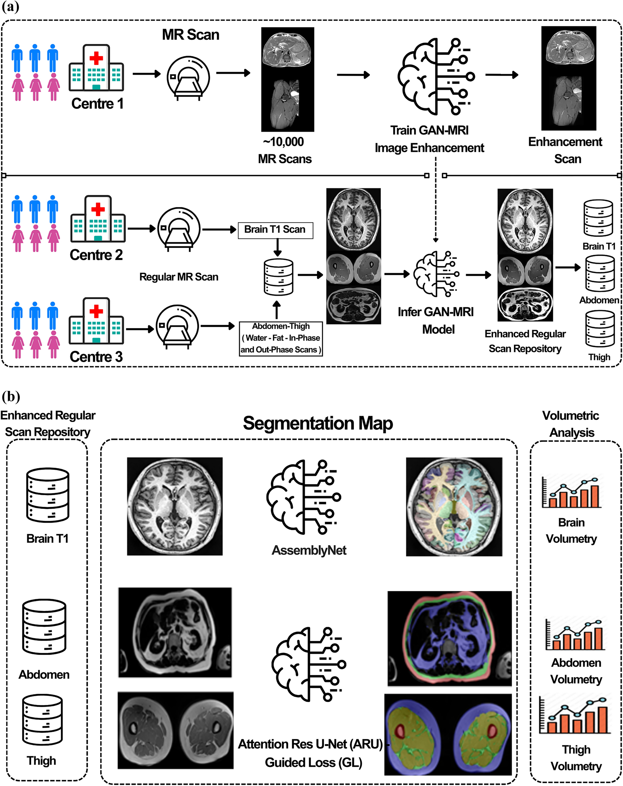 GAN-MRI enhanced multi-organ MRI segmentation: a deep learning perspective