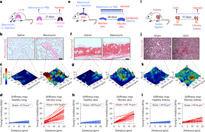 Durotaxis is a driver and potential therapeutic target in lung fibrosis and metastatic pancreatic cancer