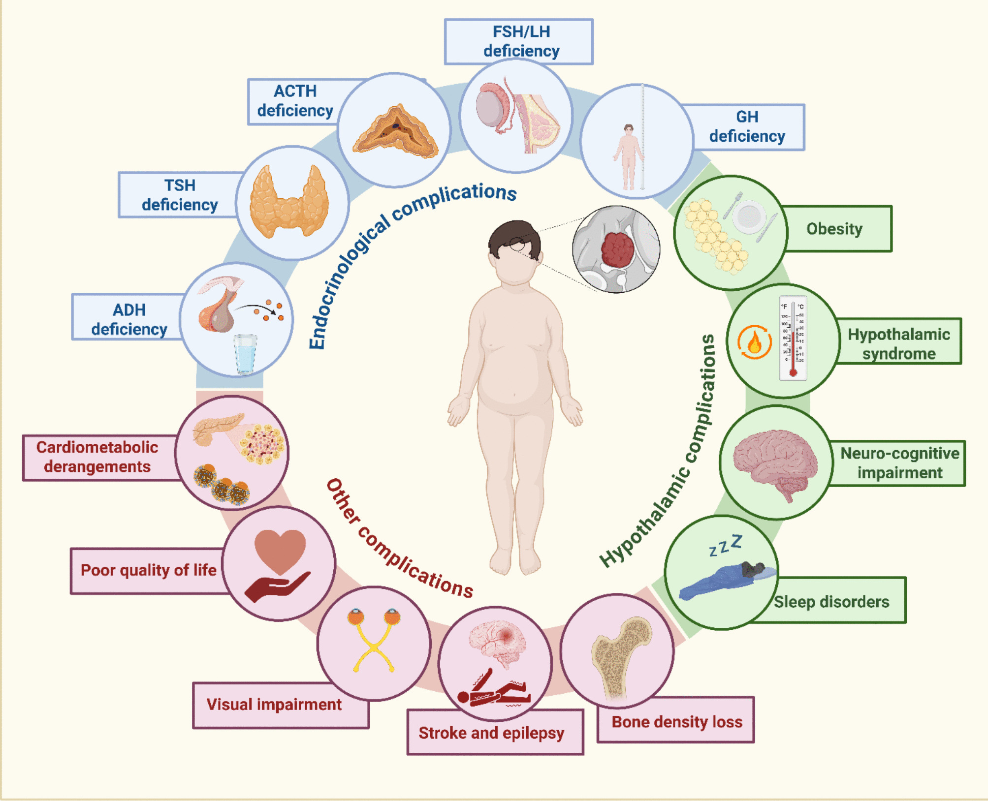 Endocrine and metabolic consequences of childhood-onset craniopharyngioma during the transition age: A literature review by the TALENT study group