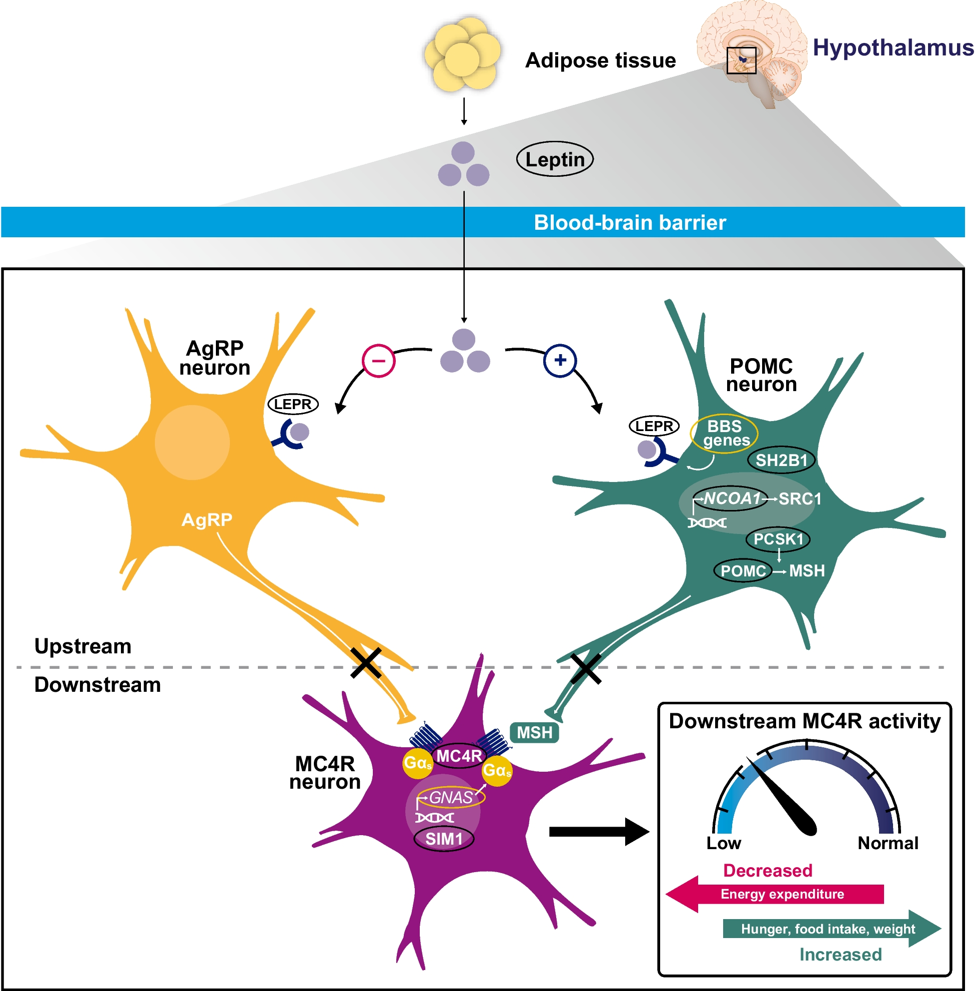 Hyperphagia in rare melanocortin-4 receptor pathway diseases: therapeutic options and assessing treatment response