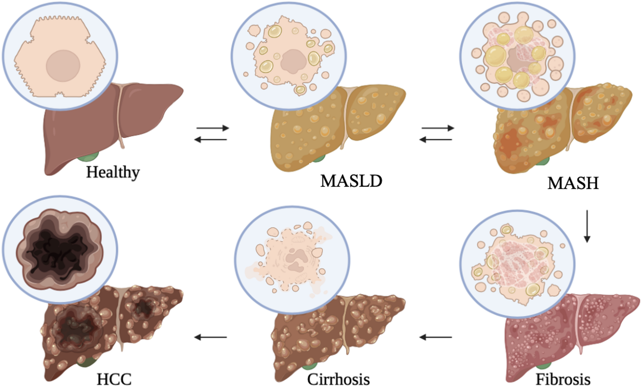 Targeted therapeutic strategies as alternative and sustainable treatment options for obesity-induced steatohepatitis