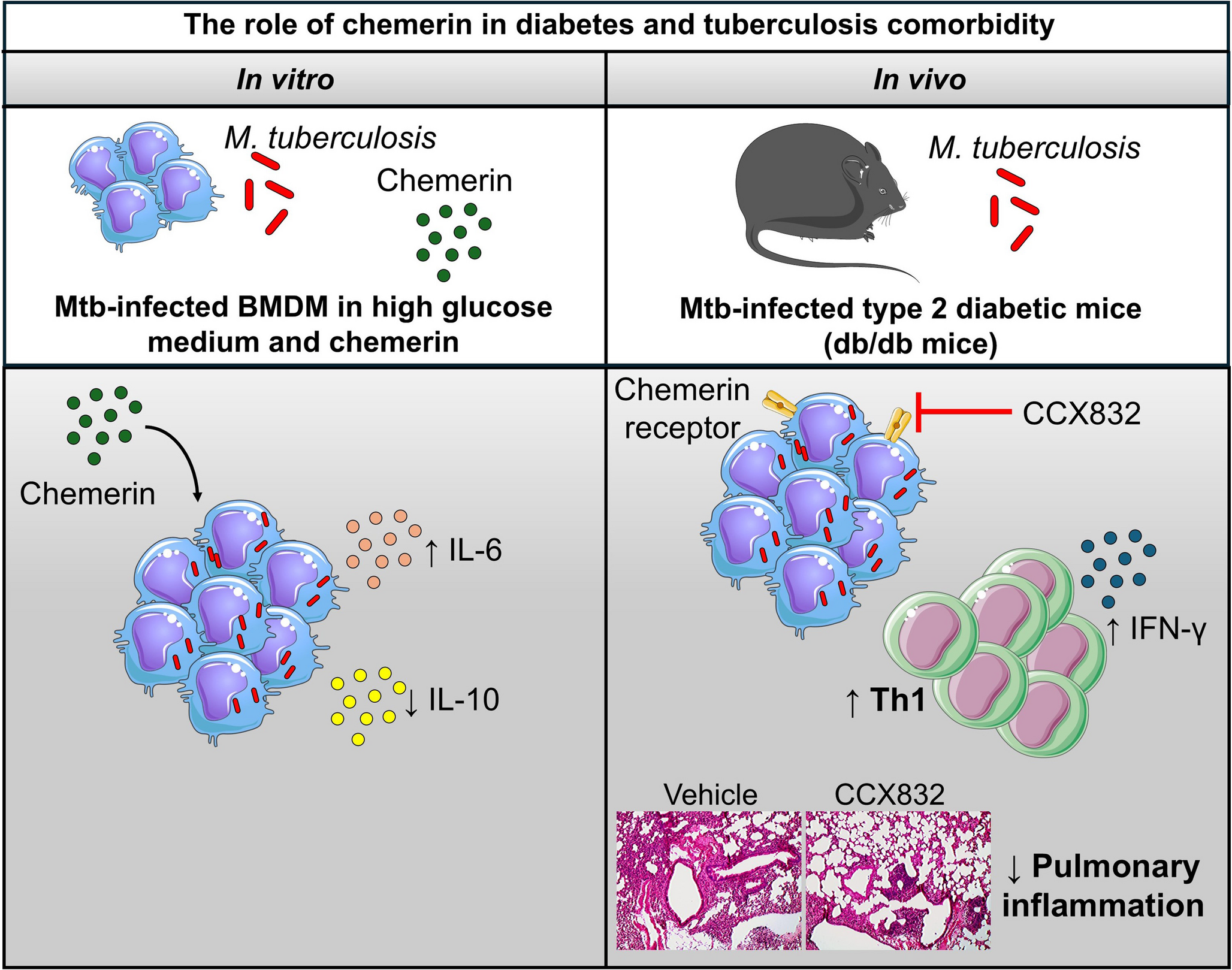 Chemerin Exacerbates Pulmonary Inflammation in Type 2 Diabetes and  Infection Comorbidity