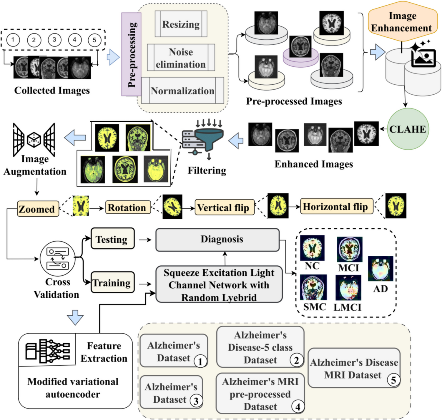 Multi-stage Alzheimer’s Disease Classification Using Squeeze Excitation Light Channel Network with a Random Lyrebird: Achieving High Sensitivity and Precision in Early Detection