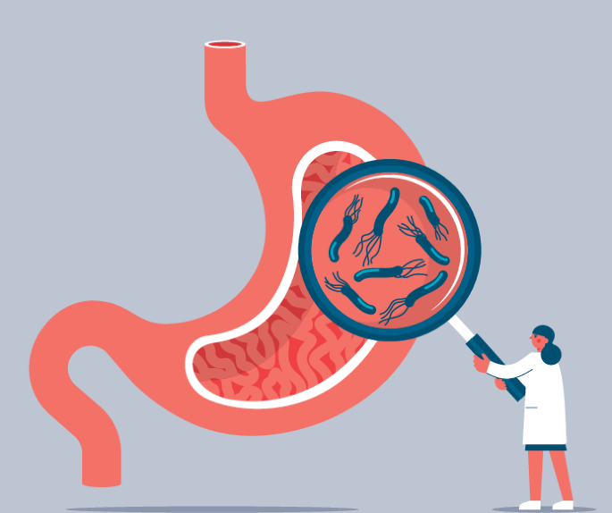 Role of Helicobacter pylori screening after myocardial infarction