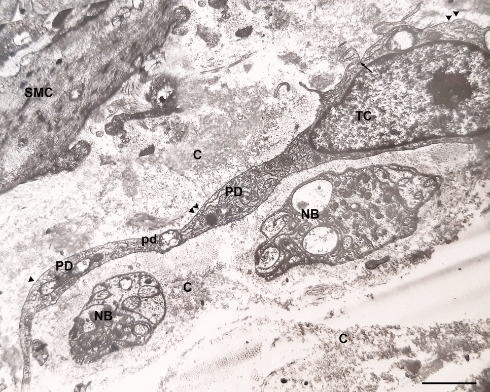 Telocytes: history, origin, identification, structure, distribution, and functions