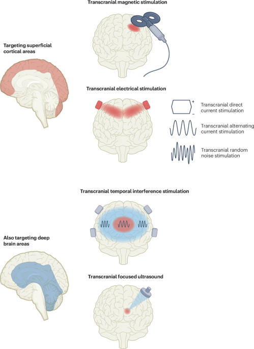Non-invasive brain stimulation: current and future applications in neurology