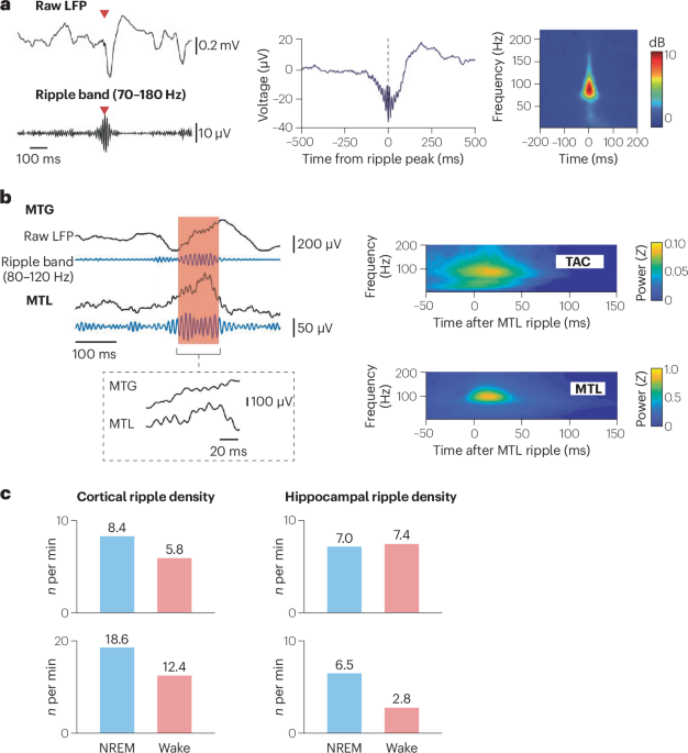 Ripple contributions to human memory: making the spiking content count