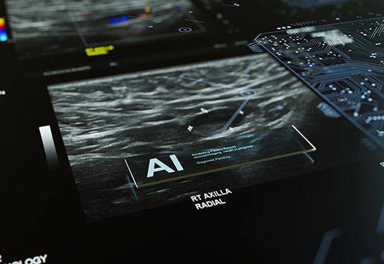 UC Davis Health to co-lead $16 million study examining AI’s role in reading mammograms