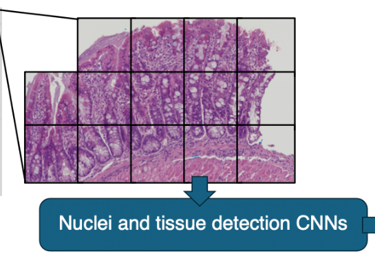 UC Davis Health receives $2.8 million grant from NIH to create AI-based digital pathology tool