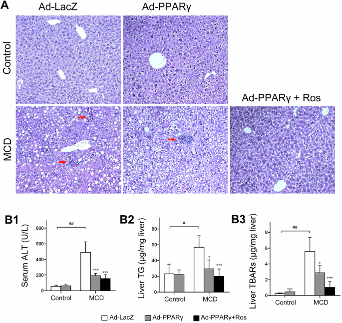 Correction: PPARγ is essential for protection against nonalcoholic steatohepatitis