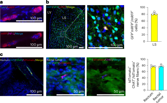 Hijacked brain–gut polysynaptic pathway promotes colorectal cancer growth