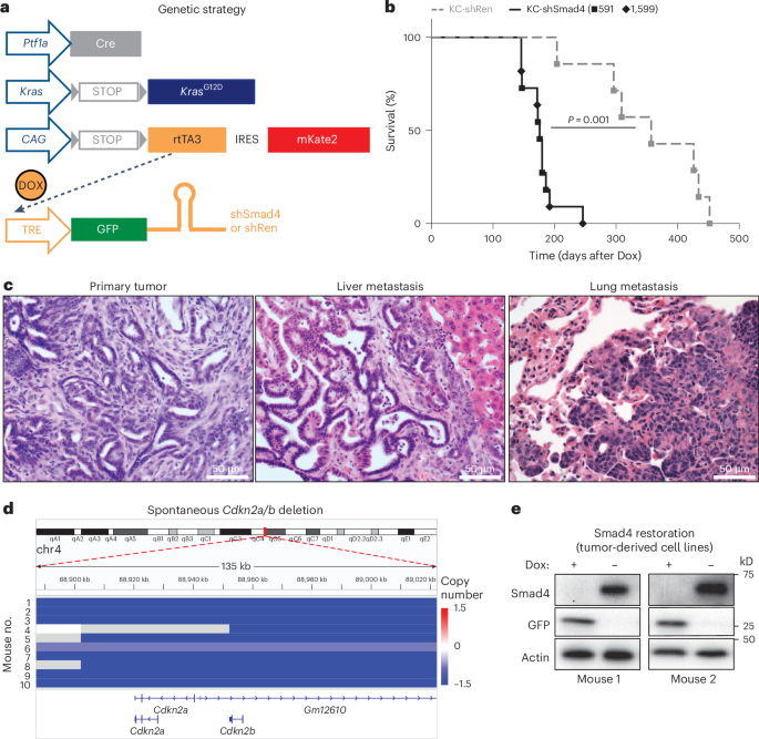 SMAD4 induces opposite effects on metastatic growth from pancreatic tumors depending on the organ of residence