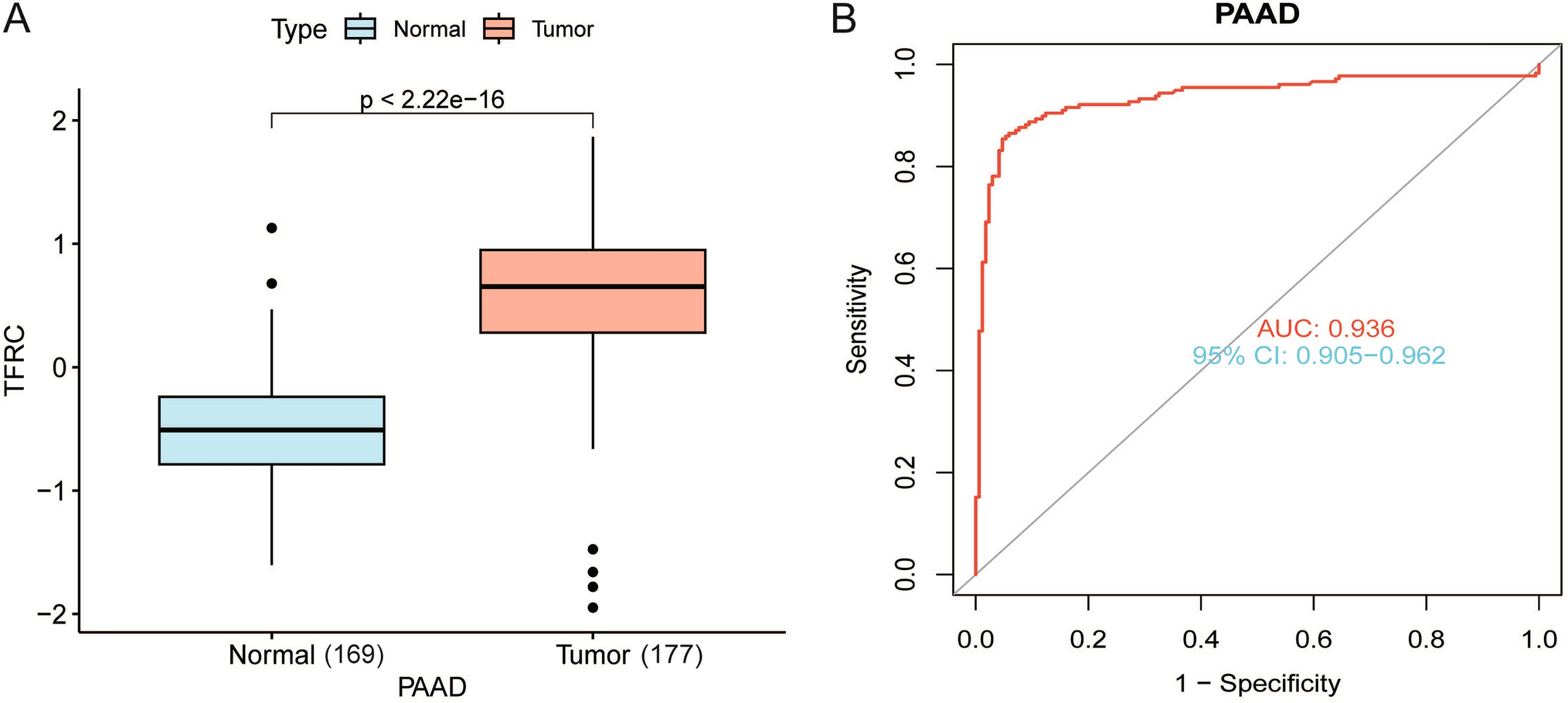 Elevated expression of transferrin receptor-1 in pancreatic cancer: clinical implications and prognostic significance