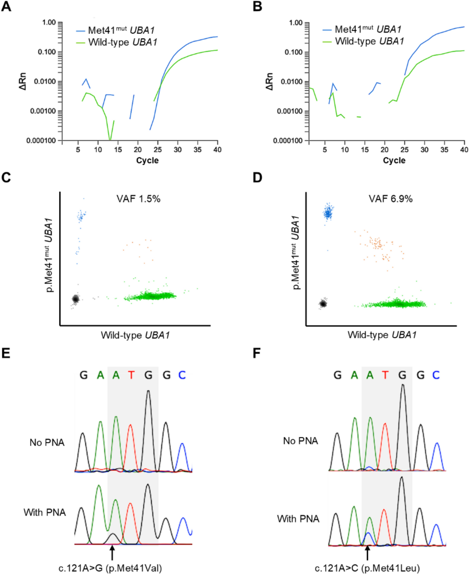 Prevalence and outcome of VEXAS syndrome in unrelated hematopoietic cell transplantation for bone marrow failure