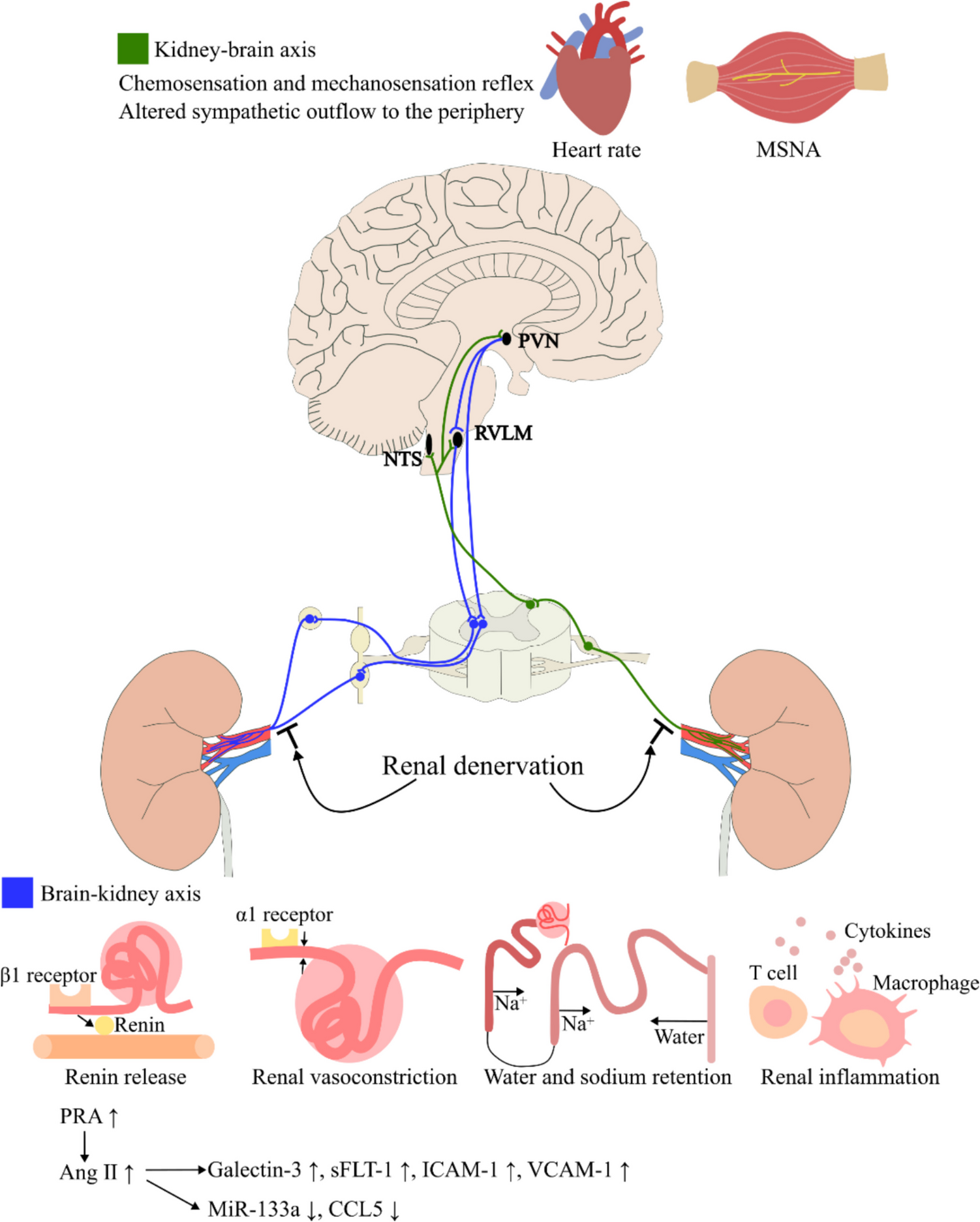 Biomarkers for Predicting Blood Pressure Response to Renal Denervation