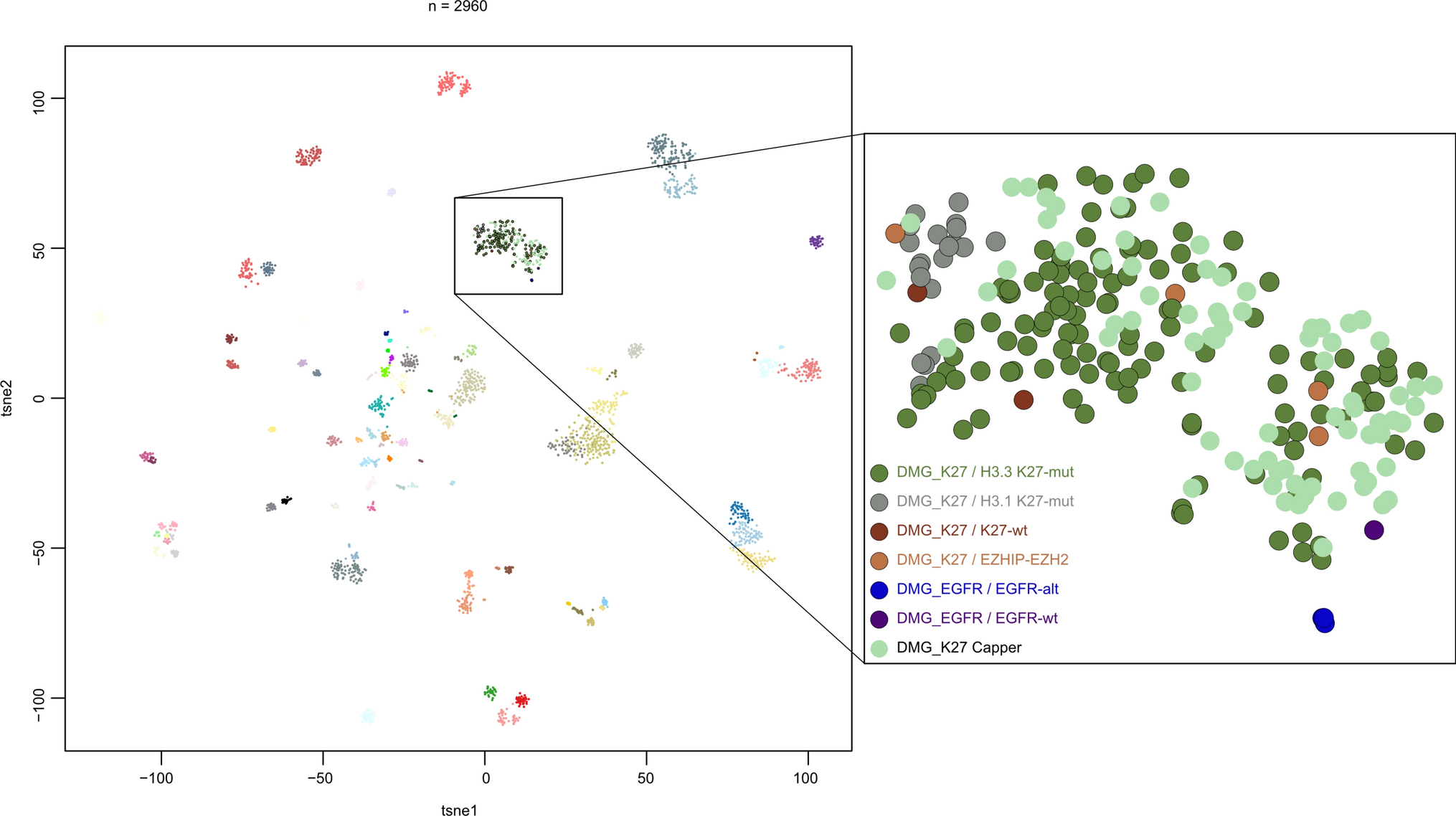 Molecular characterization and clinical features of diffuse midline glioma in the pediatric precision oncology registry INFORM