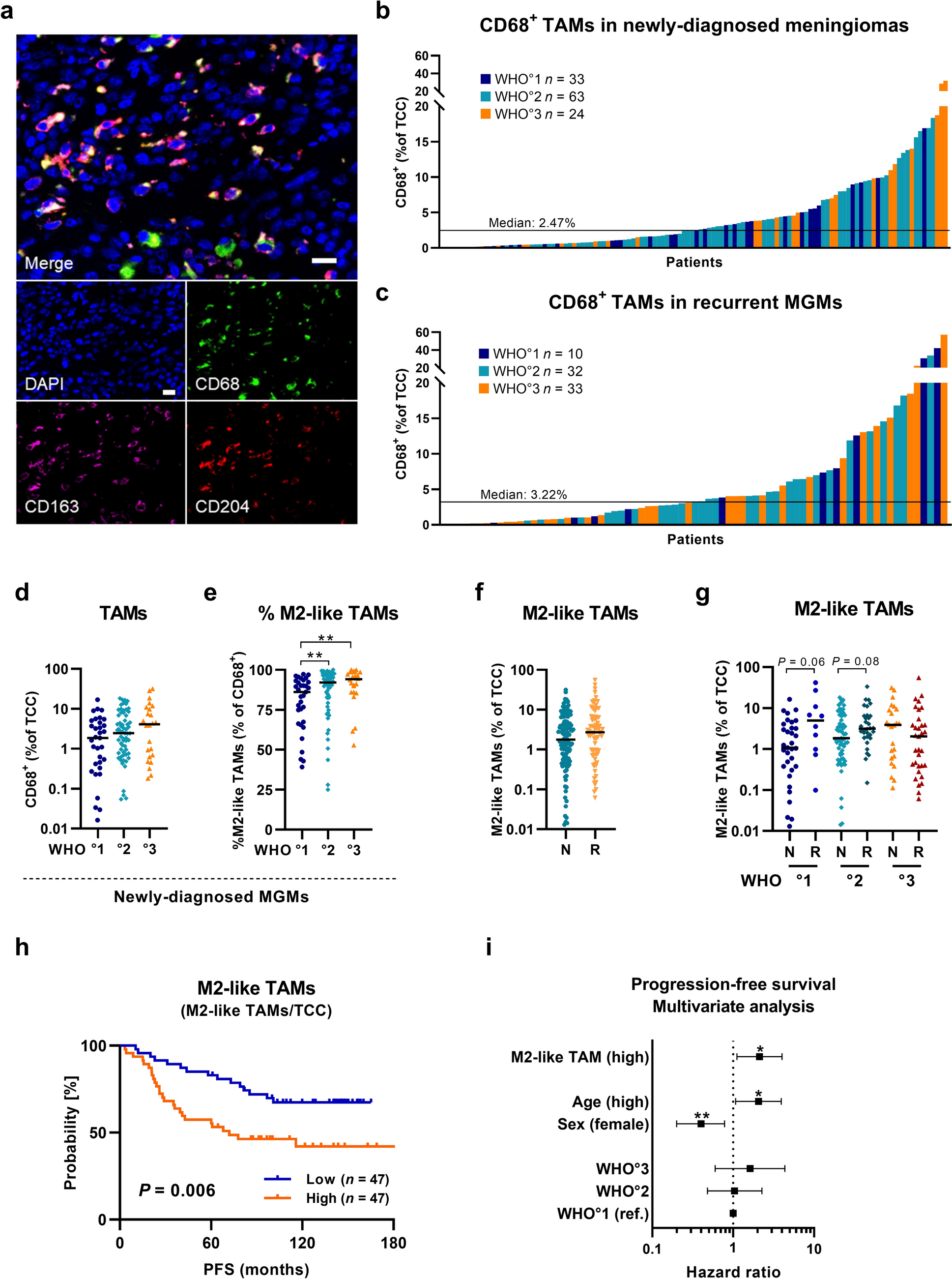 Tumor-associated macrophages in meningiomas: a novel biomarker for poor survival outperforming the benefits of T cells