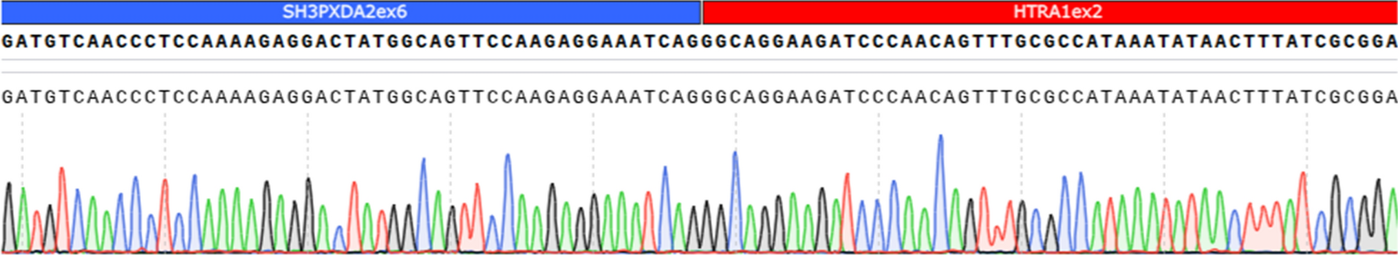 Genetic and clinical characteristics of cranial nerve schwannoma harboring  fusion gene