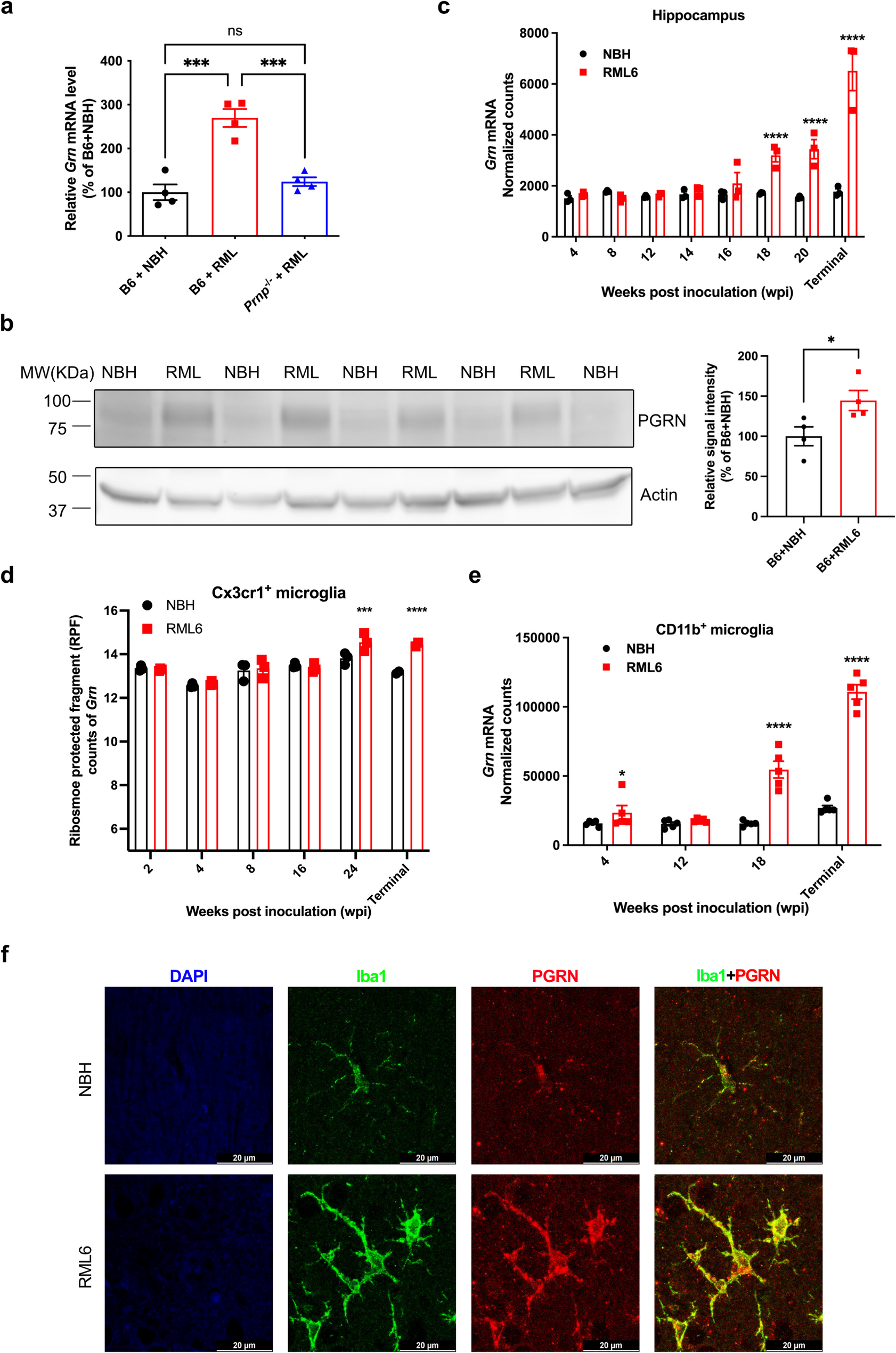Ablation of progranulin augments microglial activation and accelerates prion progression