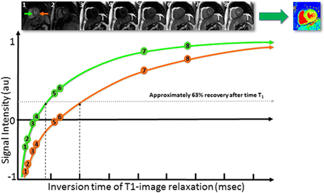 Cardiac T1 Mapping and Extracellular Volume (ECV) in clinical practice: a comprehensive review
