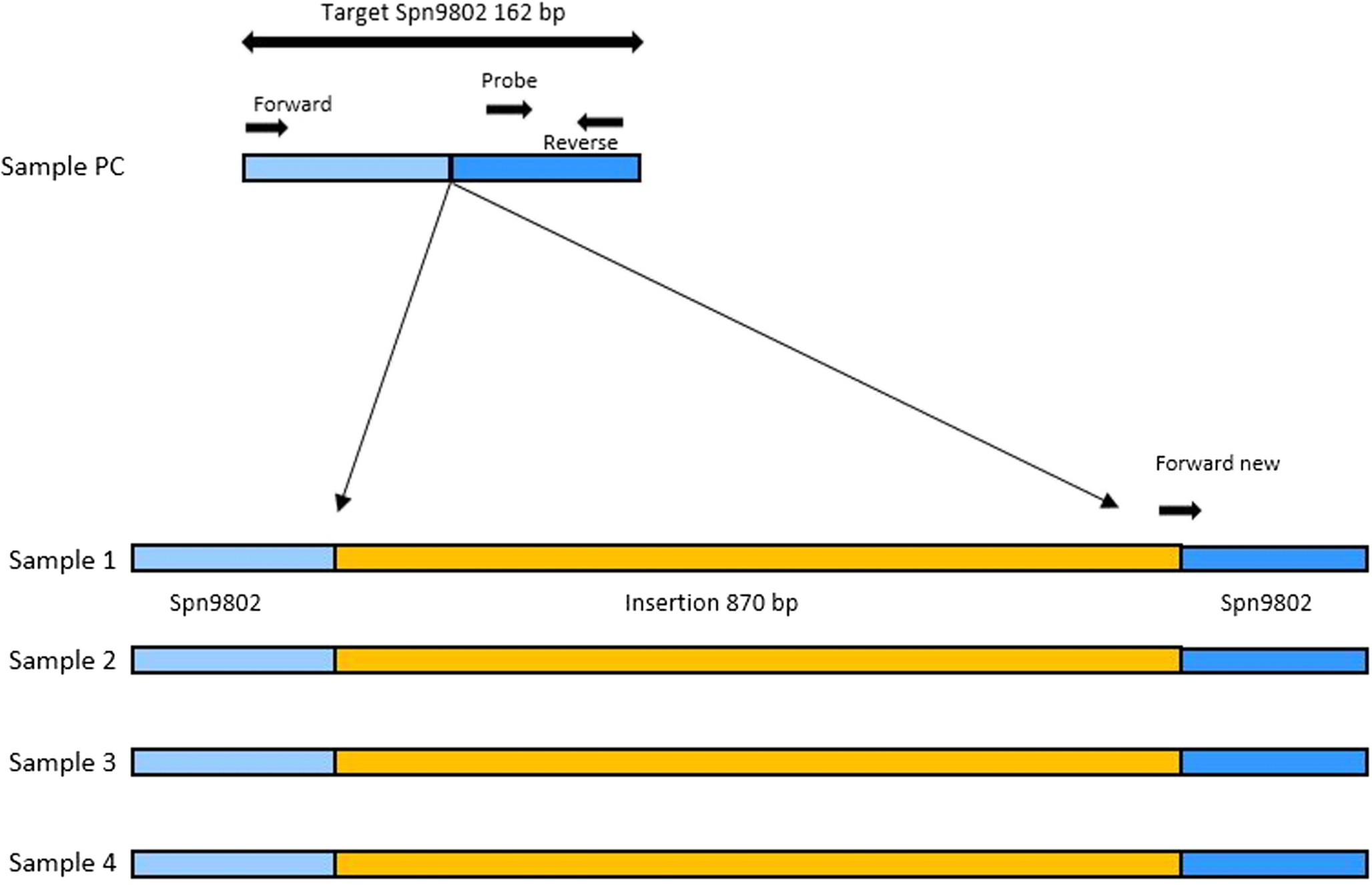 Discovery of IS transposition into the Spn9802 fragment of  and its implications for PCR-based diagnostic assays