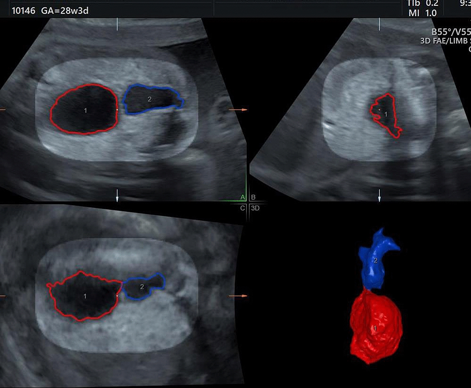 FIUVV: Associations and Outcome