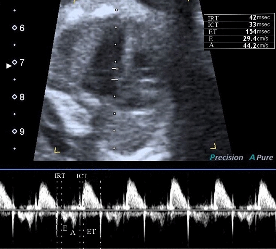 Altered Fetal Cardiac Function in Smoking During Pregnancy