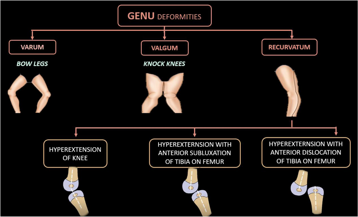 Fetal Genu Recurvatum: A Case Series