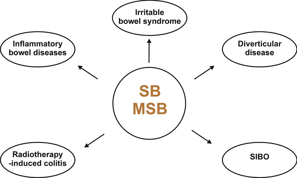 Use of Sodium Butyrate and Its Microencapsulated Forms in Intestinal Diseases—Current Clinical Approach