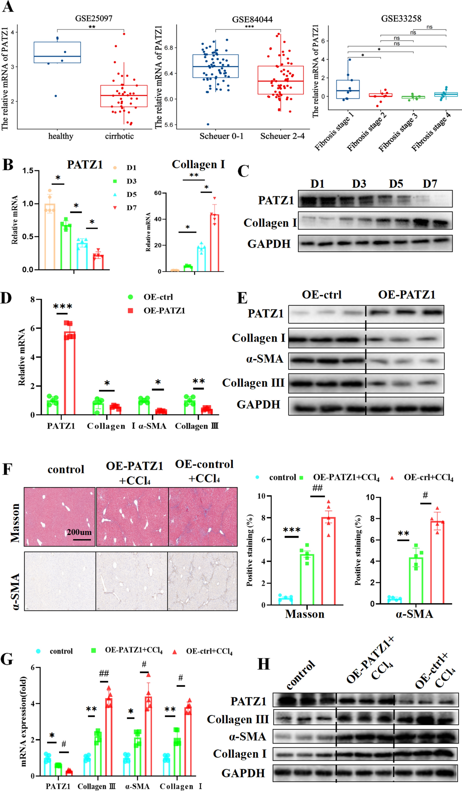 S100A6 Regulated by PATZ1 Promotes Liver Fibrosis by Activating Hepatic Stellate Cells