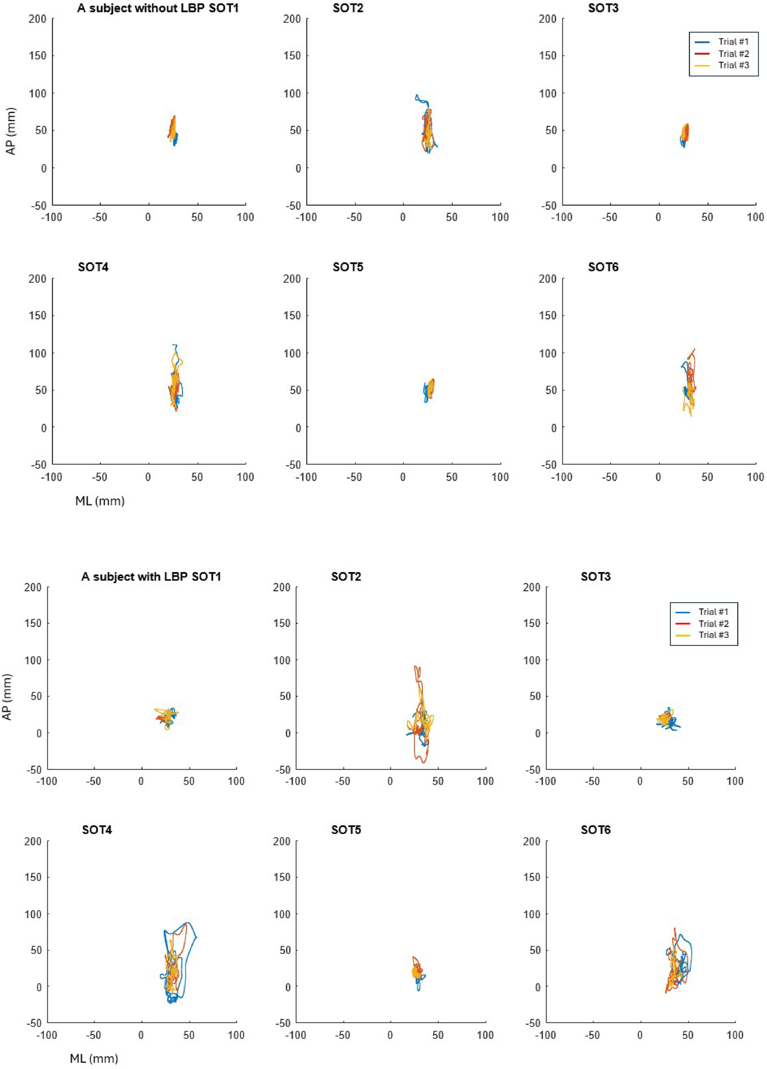 Dynamic sensory integration and visual reliance modulation during postural control in older adults with chronic low back pain