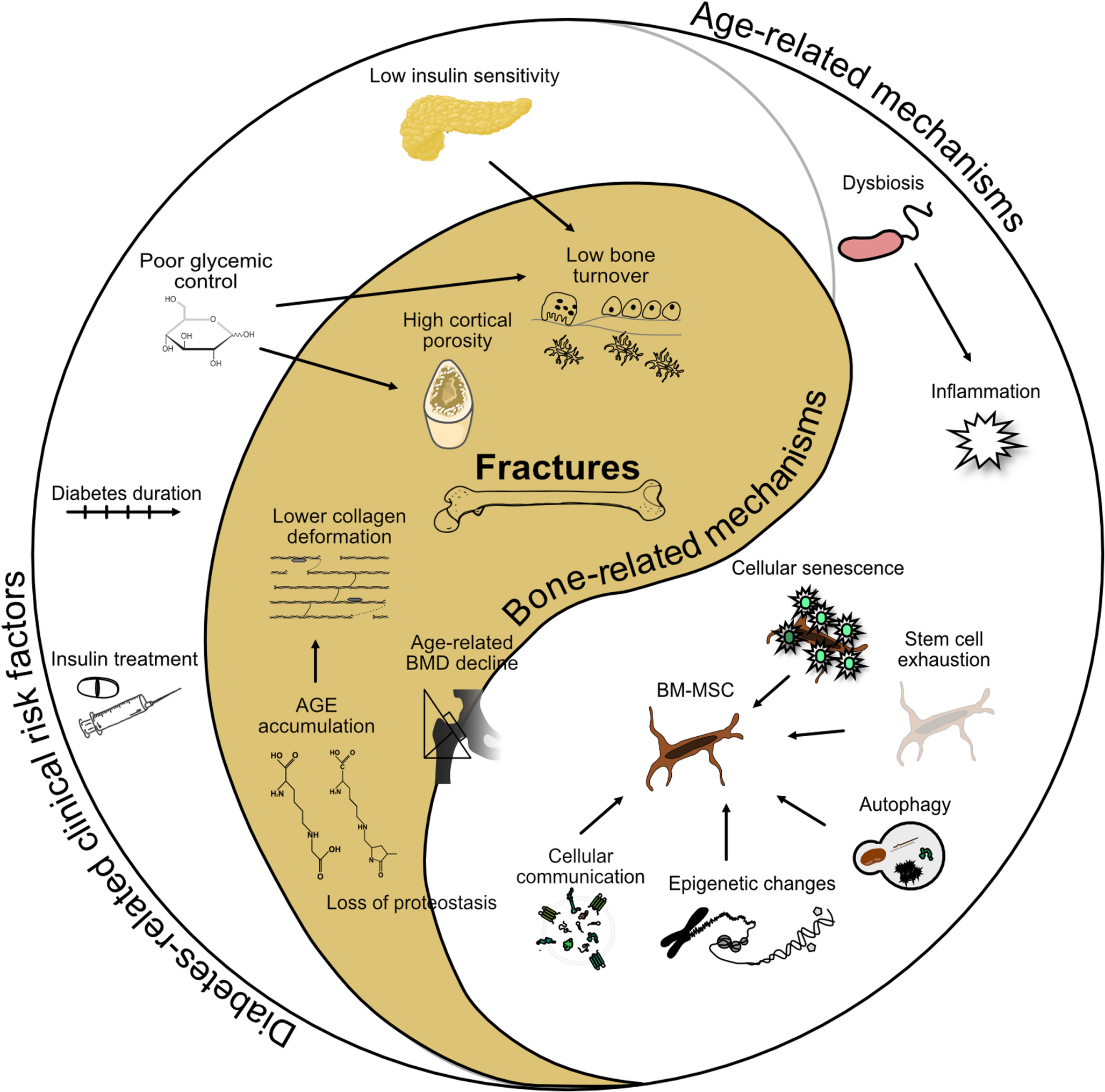 New Aspects of the Pathophysiology of Diabetic Bone Fragility – Type 2 Diabetes Mellitus as a Disease of Accelerated Aging