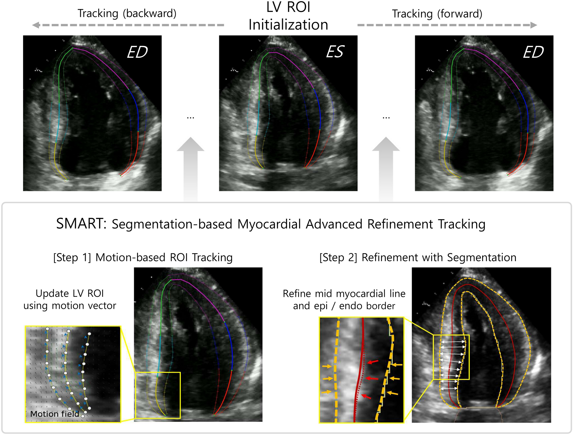 Novel deep learning framework for simultaneous assessment of left ventricular mass and longitudinal strain: clinical feasibility and validation in patients with hypertrophic cardiomyopathy