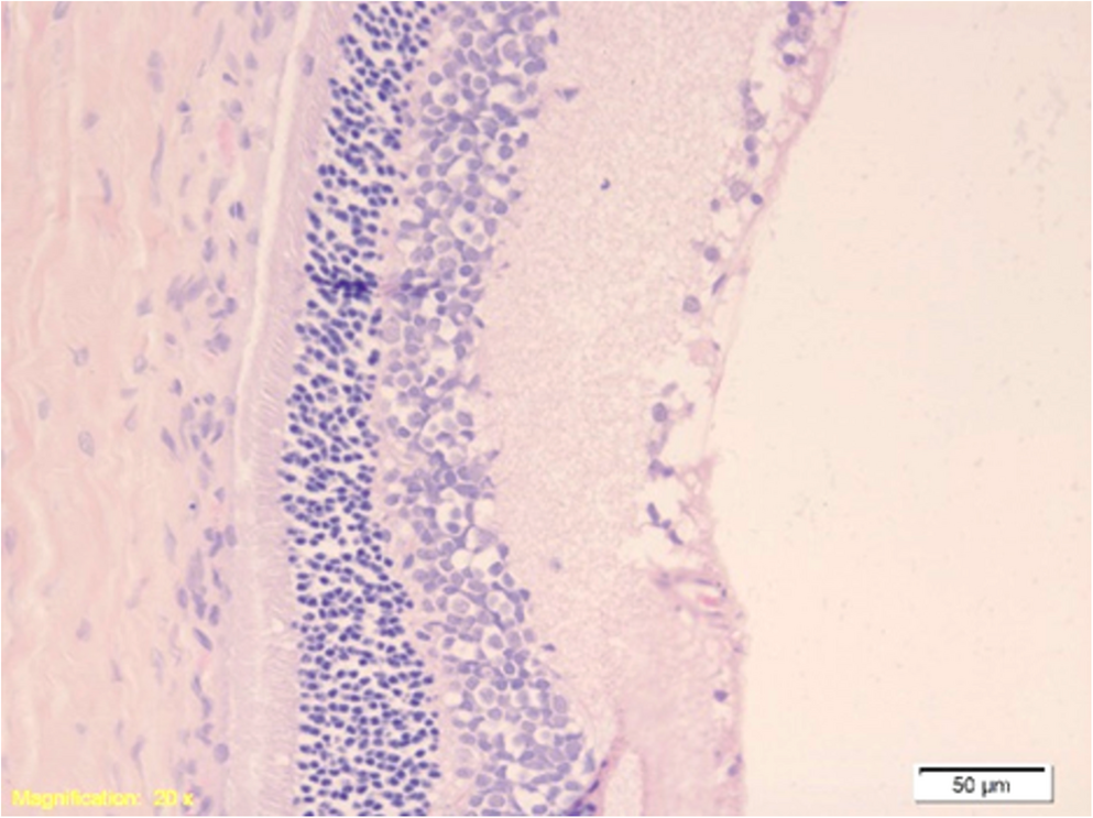 Monitoring changes in the eyes - the significance of the post-mortem interval in asphyxia