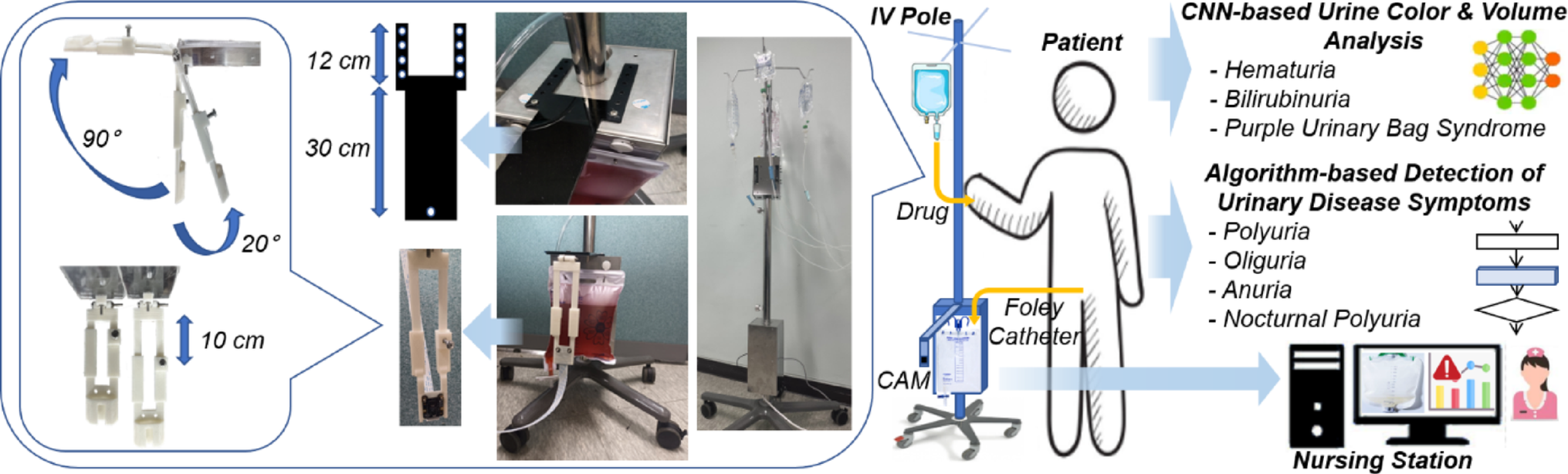 Intravenous pole-integrated automated urinary status-monitoring technique using image-based artificial intelligence: a simulation study