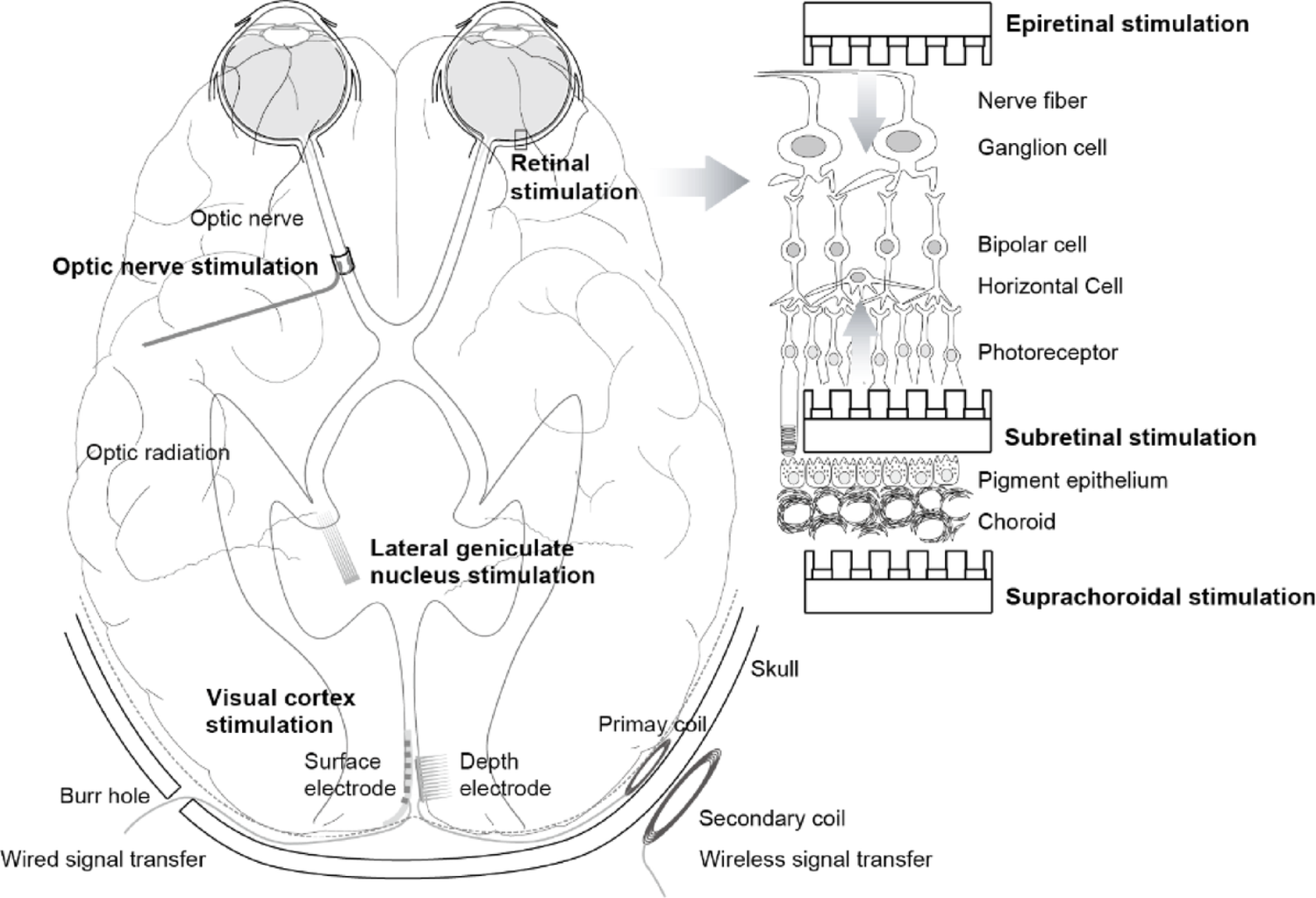 Advances in artificial vision systems: a comprehensive review of technologies, applications, and future directions