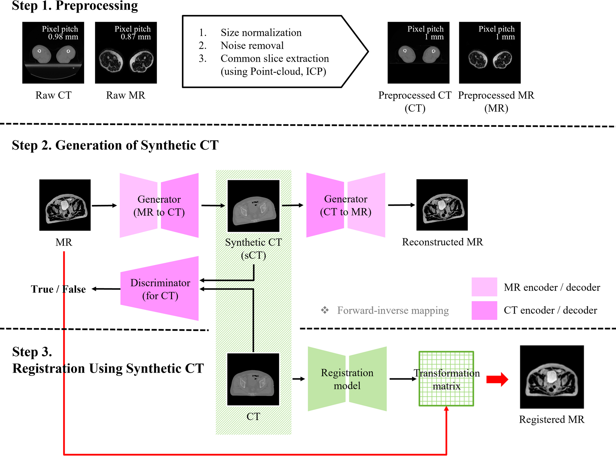Image registration using MR-based synthetic CT (sCT) generated by cycle-consistent adversarial networks