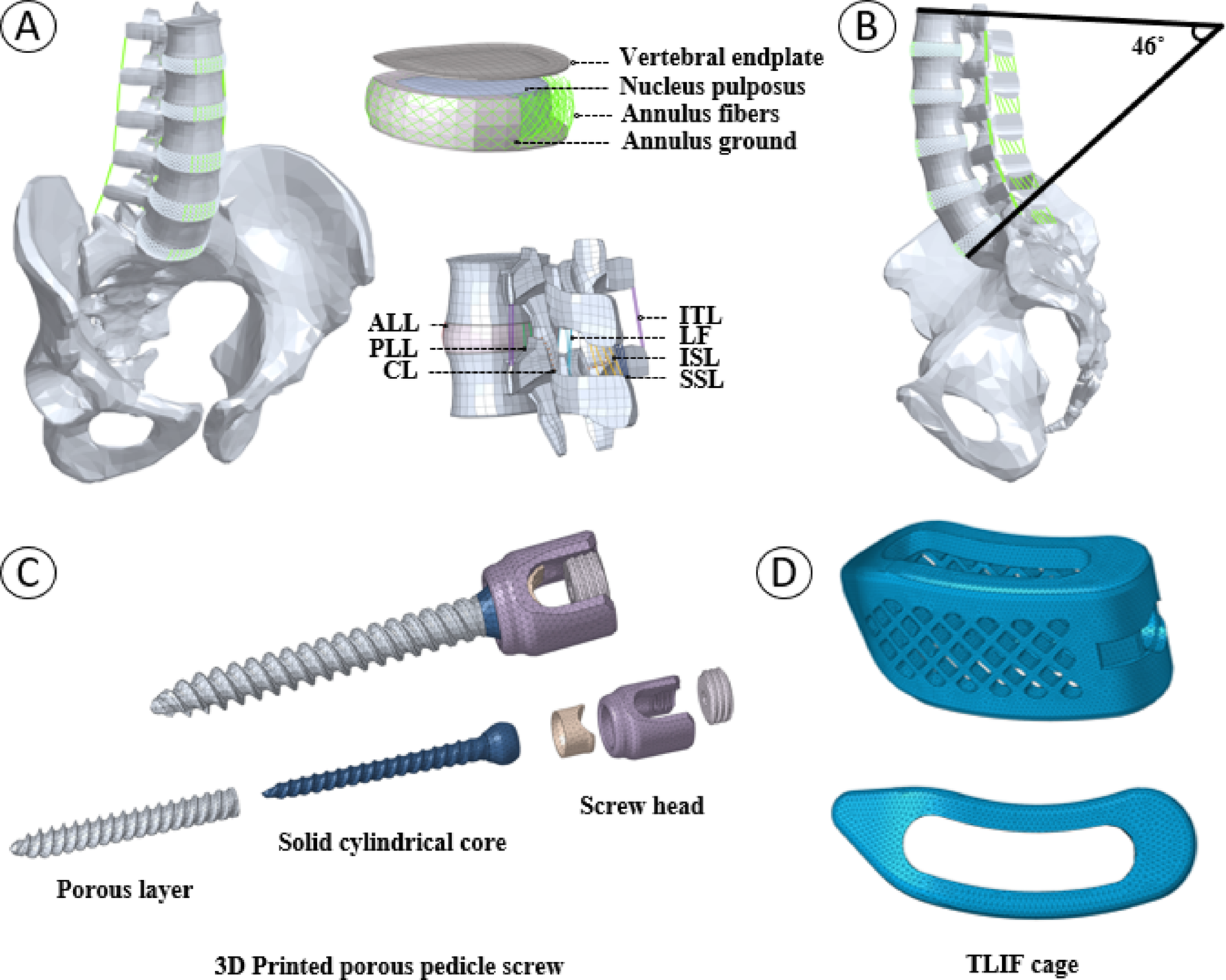 Evaluation of the porosity and structural stability of 3D-printed porous titanium pedicle screws using finite element analysis