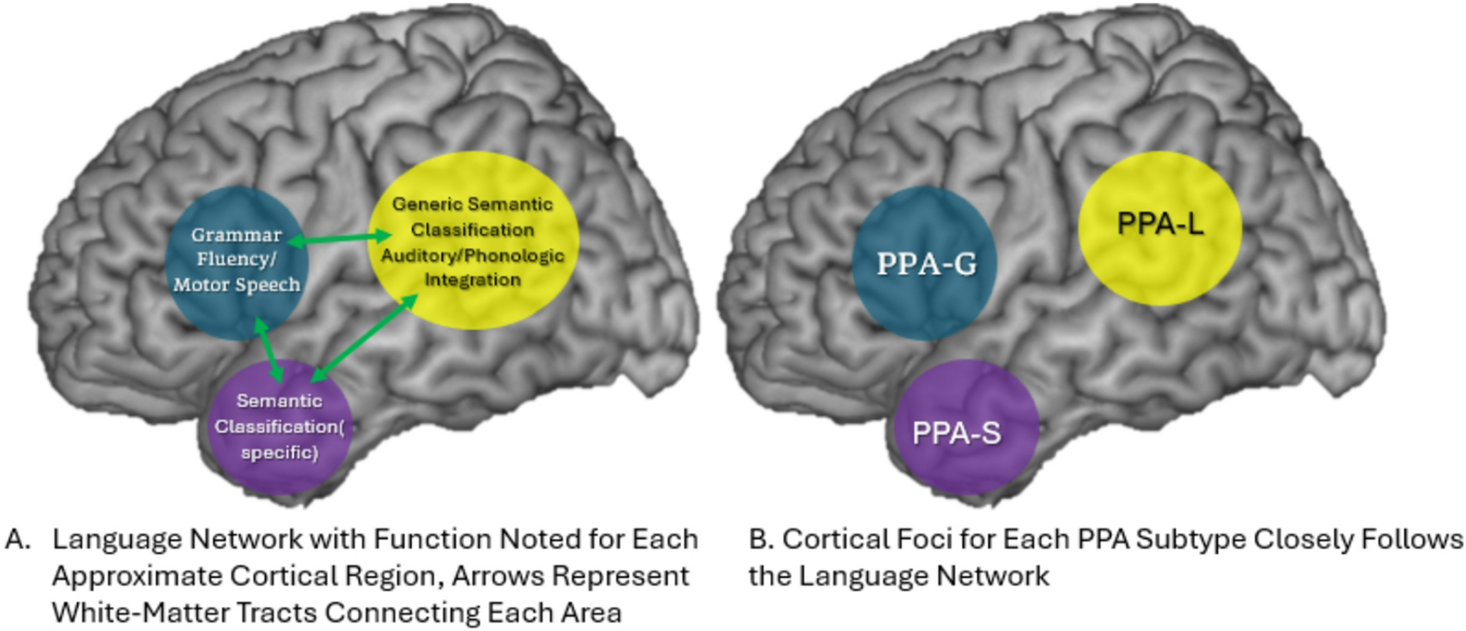 Primary Progressive Aphasia Treatment: Current Treatment Options in Neurology Article Topic: Management of Primary Progressive Aphasia
