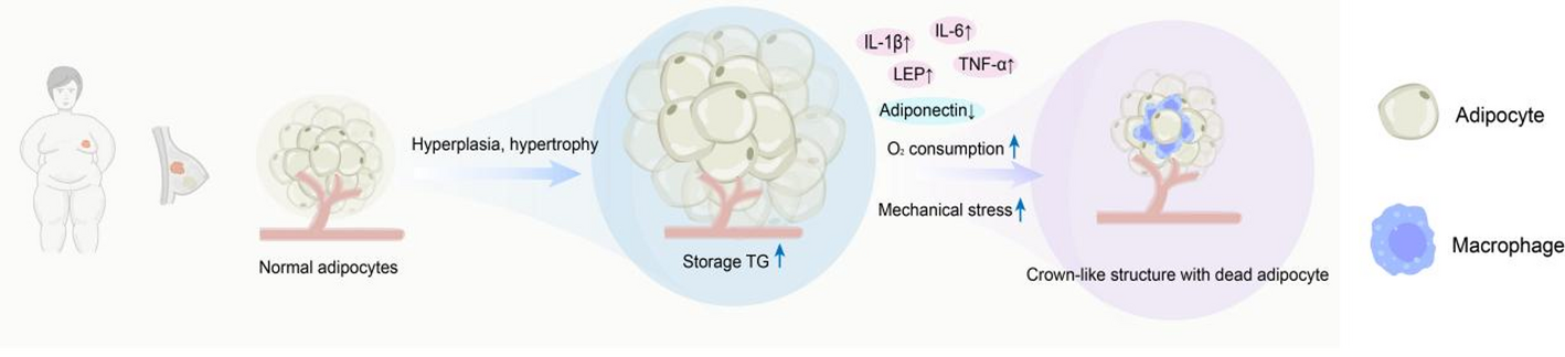 Exploring the biological mechanisms of obesity affecting breast cancer from a multidimensional perspective