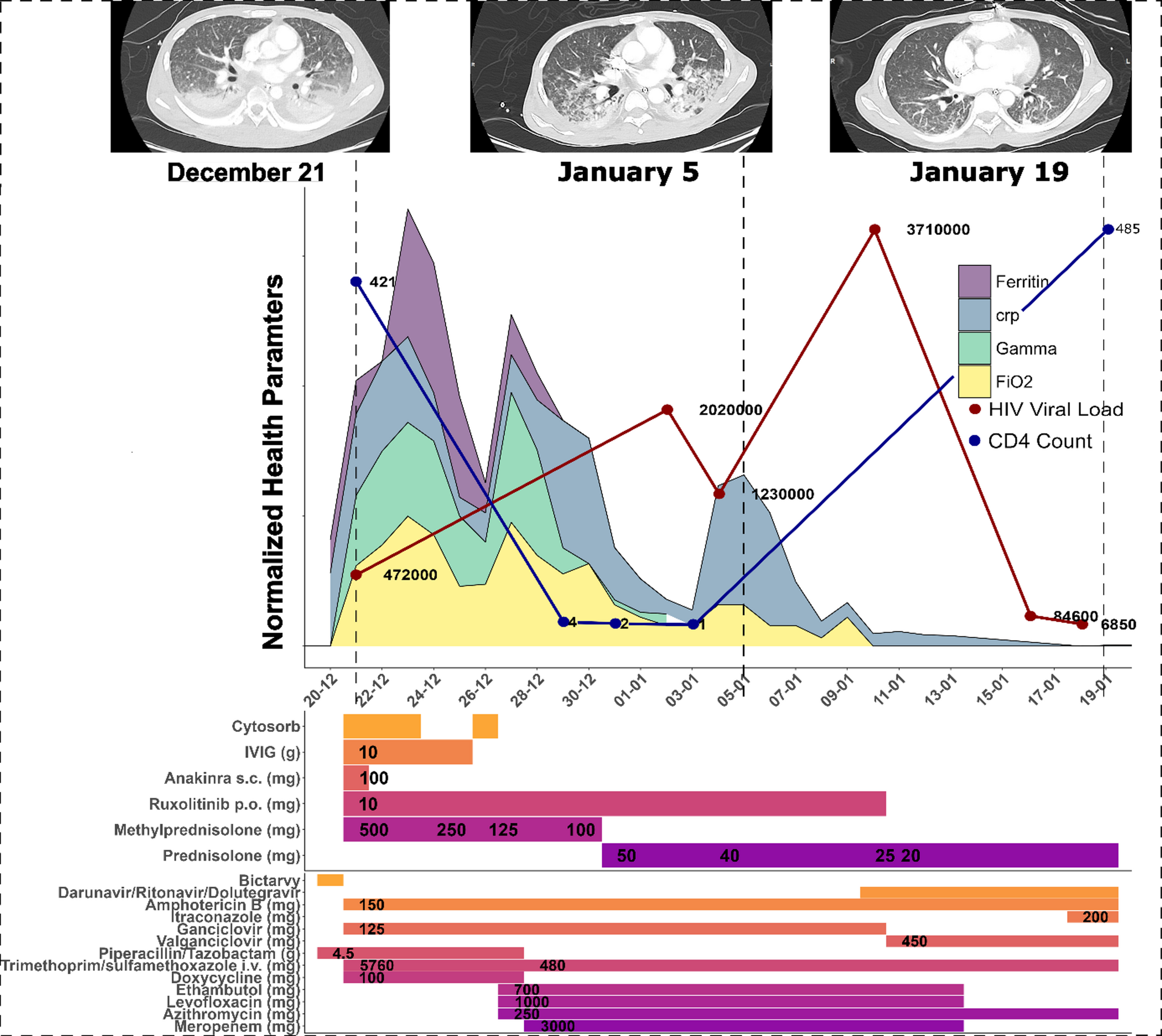 Successful management of severe IRIS associated with disseminated histoplasmosis in an HIV patient using cytokine adsorption therapy and JAK inhibition