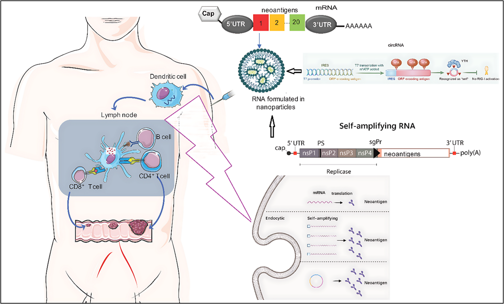 RNA-based cancer vaccines: mechanisms, clinical progress, and translational challenges