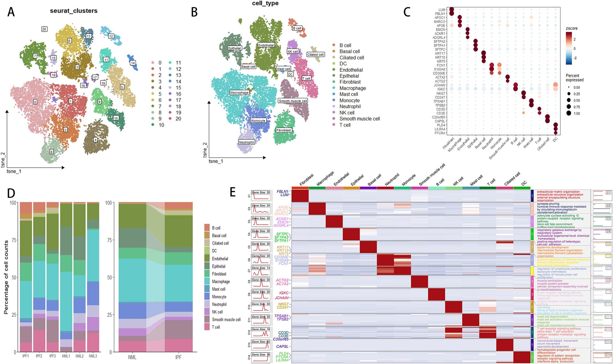 IGFBP7 and CCT2 are novel lactylation-driven mediators of endothelial-to-mesenchymal transition in idiopathic pulmonary fibrosis