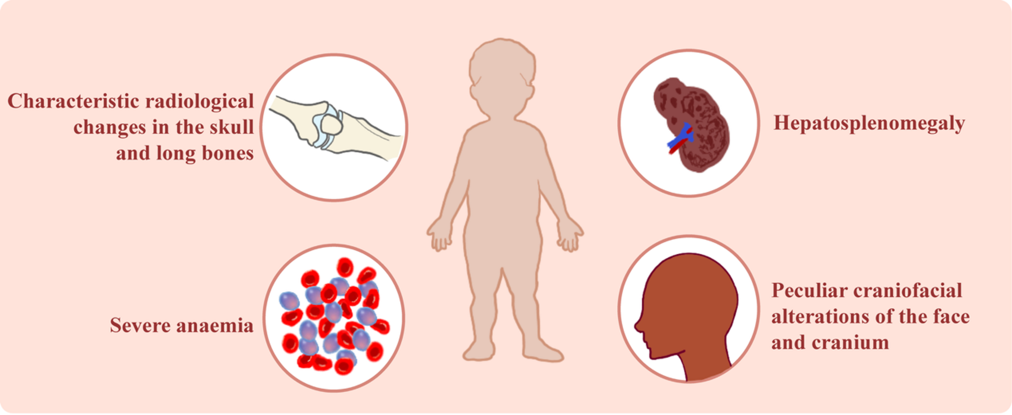 Cellular and molecular targets in β-Thalassemia: advances in iron Regulation, Erythropoiesis, and Gene-Based therapies