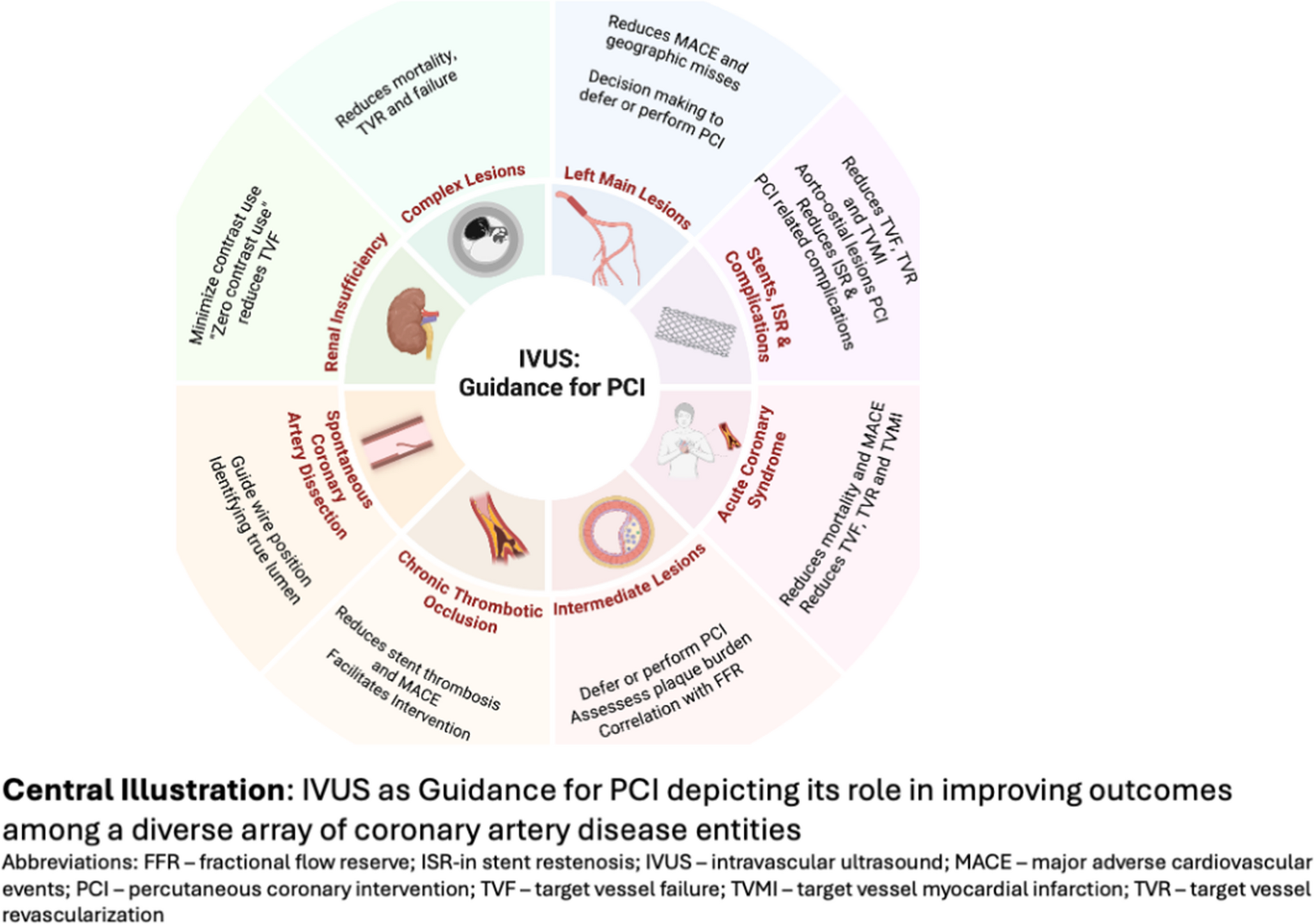 Intravascular Ultrasound: an Essential for Percutaneous Coronary Intervention Guidance