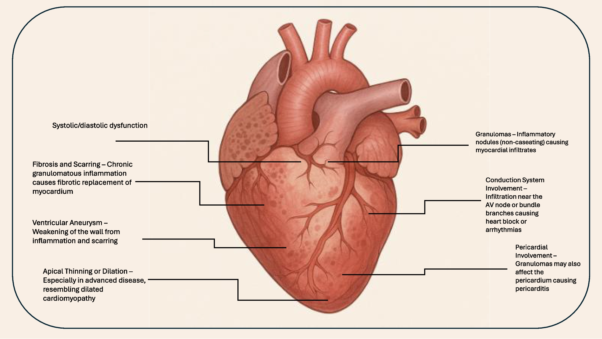 Multimodality Imaging in the Contemporary Work-Up of Cardiac Sarcoidosis
