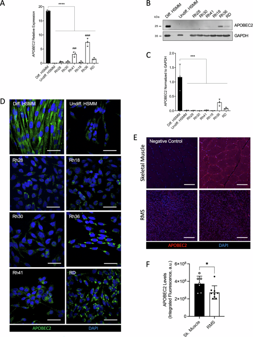 Pannexin 1 induces Rhabdomyosarcoma cell fusion by downregulating APOBEC2