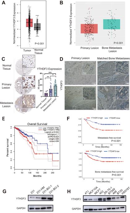 YTHDF3 promotes breast cancer osteolytic bone metastasis by enhancing the translation of ZEB1 and SMAD5