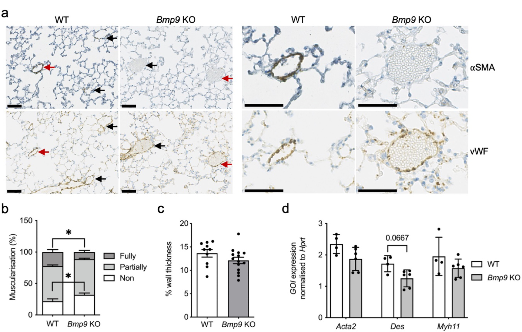 BMP9 knockout impairs pulmonary vessel muscularisation and confers aberrant tamoxifen sensitivity