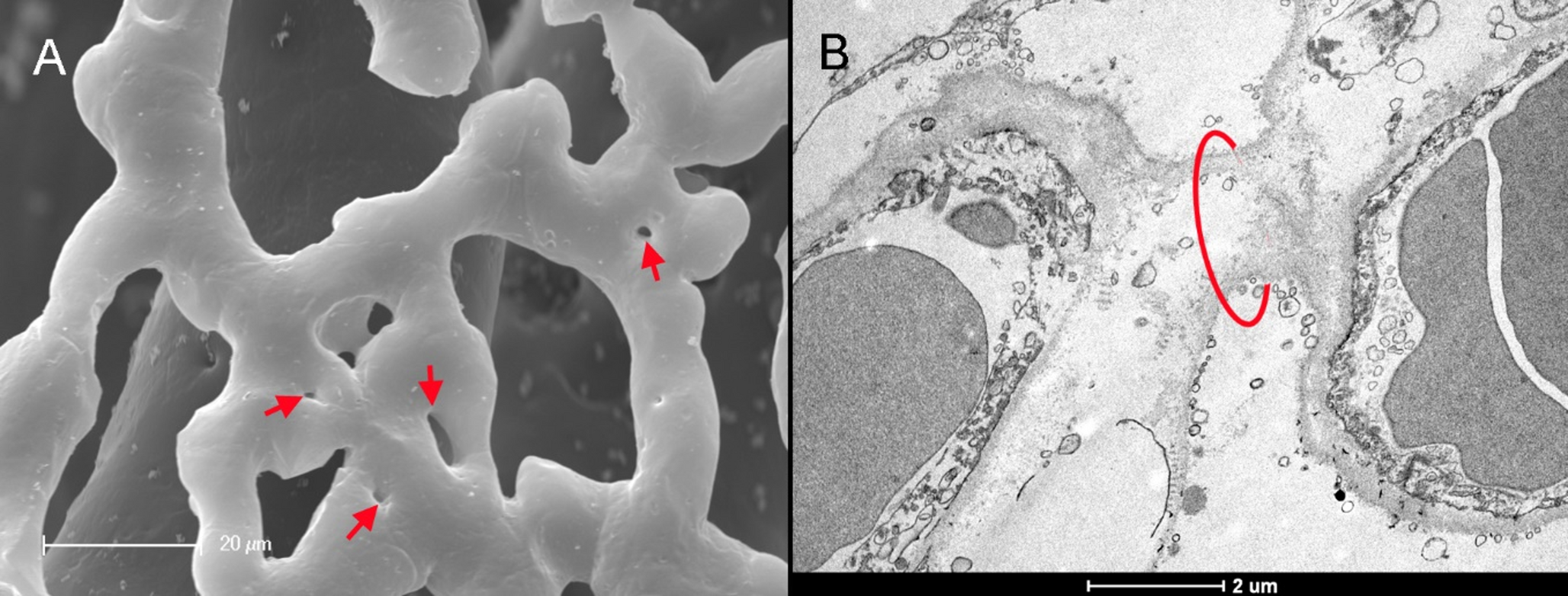 Intussusceptive angiogenesis: bridging in vivo and in vitro observations